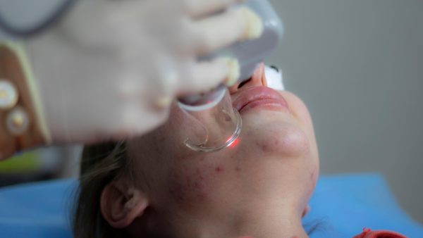 Facial Lymphatic Drainage Massage